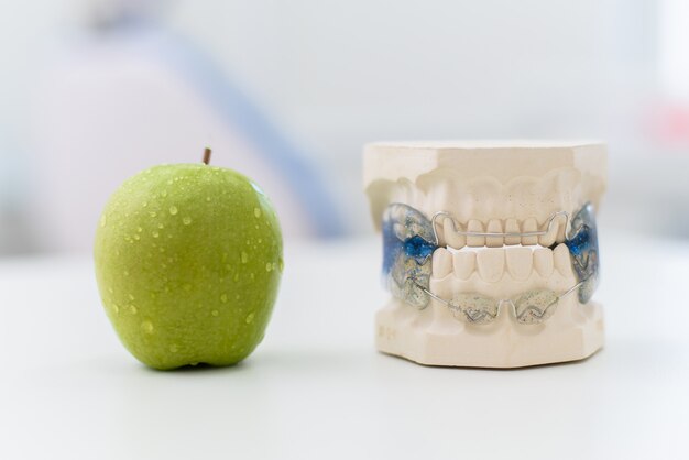 Ceramiczne szczęki z zapięciem leżą na stole z jabłkiem Premium Zdjęcia
