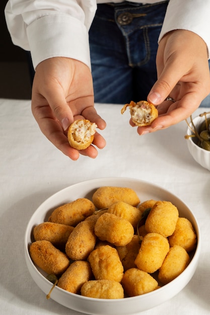 Composición De Deliciosas Croquetas Españolas Foto Gratis 1367