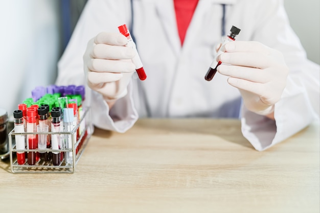 Doctor Mano Sujetando El Tubo De Sangre Para Análisis De Sangre Equipo Médico Tubo De Análisis