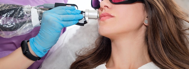 depilacion laser bigote mujer