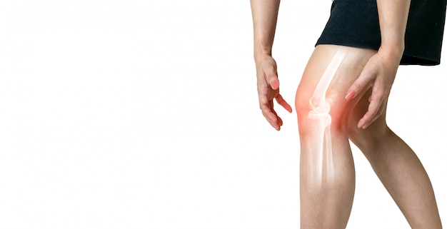 La pierna humana osteoartritis inflamación de las articulaciones óseas sobre fondo blanco. Foto Premium 