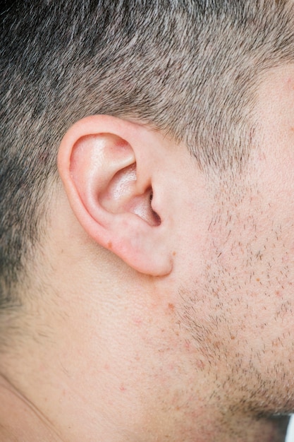 Primer Plano De La Oreja Del Hombre Blanco Foto Gratis