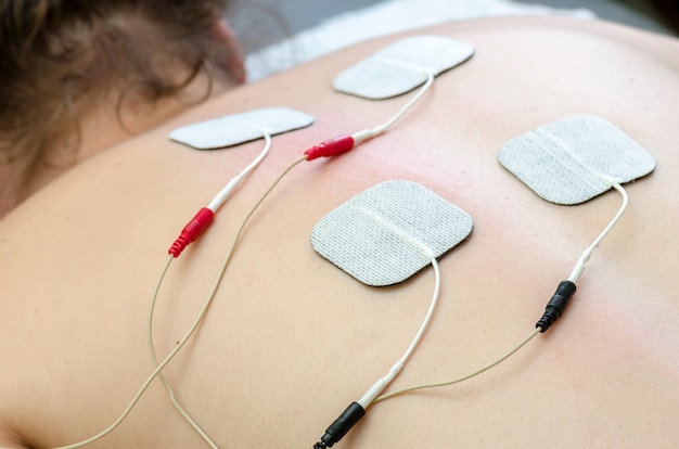 Tens Electrodos Posicionados Para El Tratamiento Del Dolor De Espalda En Fisioterapia Foto Premium