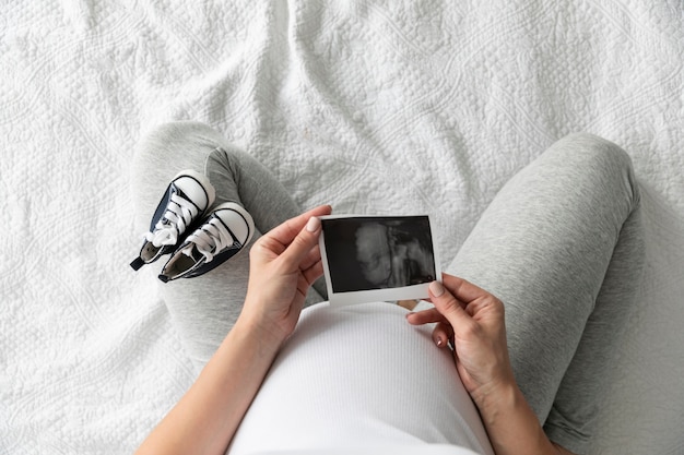 Vista superior mujer embarazada sosteniendo una imagen de ultrasonido Foto gratis