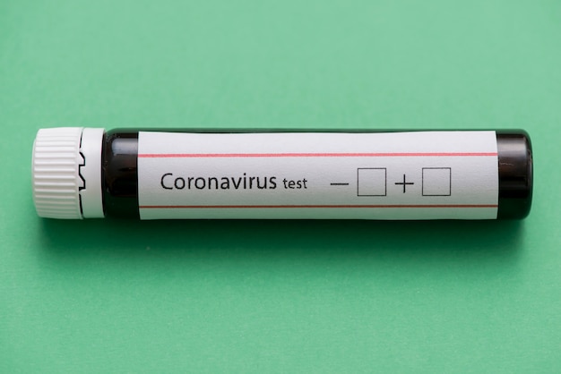 Test di coronavirus su sfondo verde Foto Gratuite