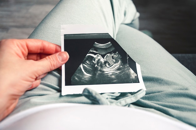 Una ragazza tiene una foto di un bambino ultrasuoni nella sua ventesima settimana di gravidanza. Foto Premium