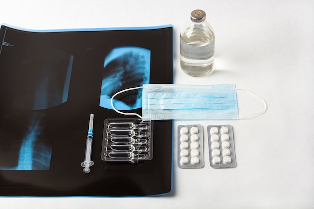 Cum să recunoaşteţi simptomele osteocondrozei Unguente pentru osteocondroza toracică cervicală