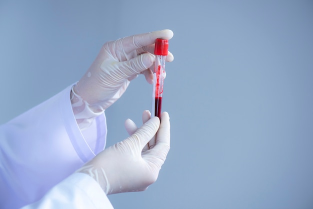 Doutor, mão, com, luva latex, segurando sangue, tubo teste, ligado, esterilize, sala Foto Premium
