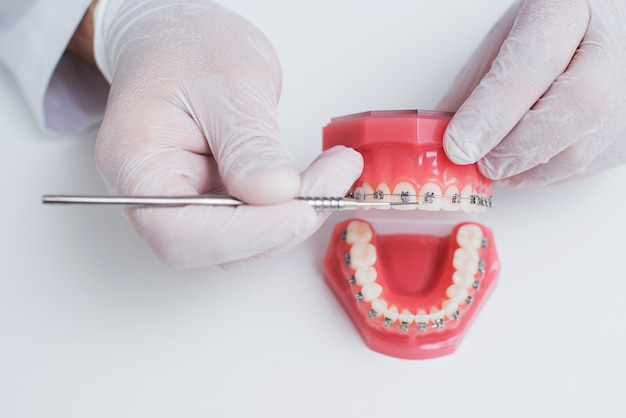 Médico ortodontista mostra como o sistema de aparelho nos dentes é organizado Foto Premium