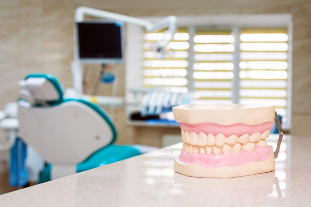 Modelos de maxila humana em um consultório de dentista, cuidados com os dentes e conceito de próteses. Foto Premium