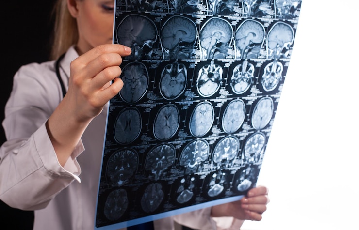 Mulher Jovem Médica Profissional Em Jaleco Branco Segurando Ressonância Magnética Do Cérebro 3651