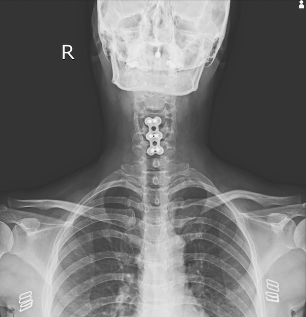 Raios x c-spines Foto Premium