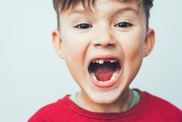 Retrato De Uma Crian A A Boca Aberta Que Um Dente Caiu Foto Premium