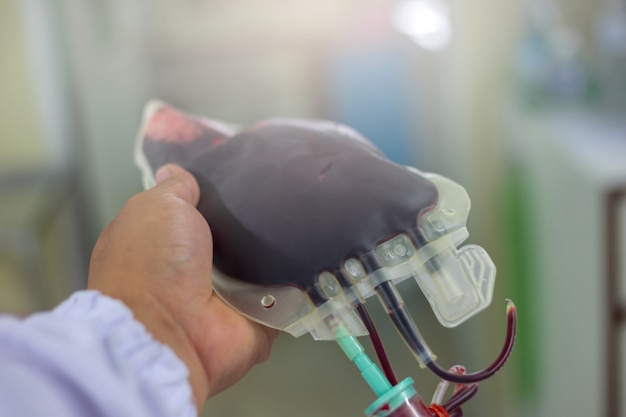Sangue no saco de sangue para pacientes Foto Premium