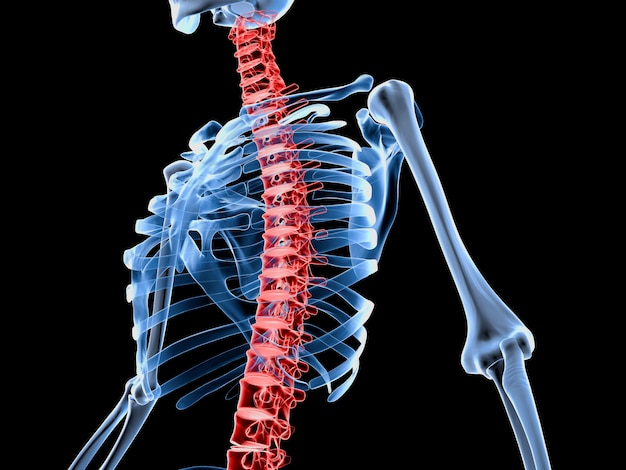 背中の痛みを伴う骨格の3 Dレンダリングされた図 プレミアム写真