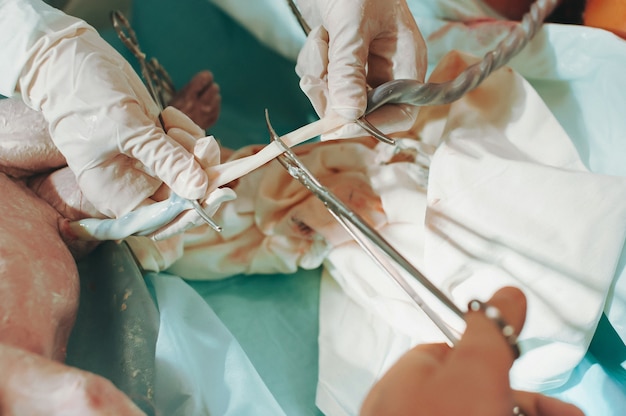 医師が新生児のへその緒をクリップで握り 父親が産院ではさみで臍帯を切る 赤ちゃんの誕生 ヘルスケアの概念 プレミアム写真