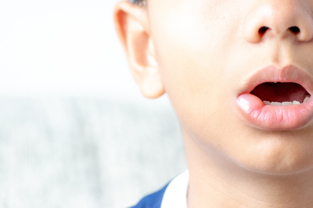 premium-photo-allergic-reaction-on-child-mouth-skin-after-bee-stings