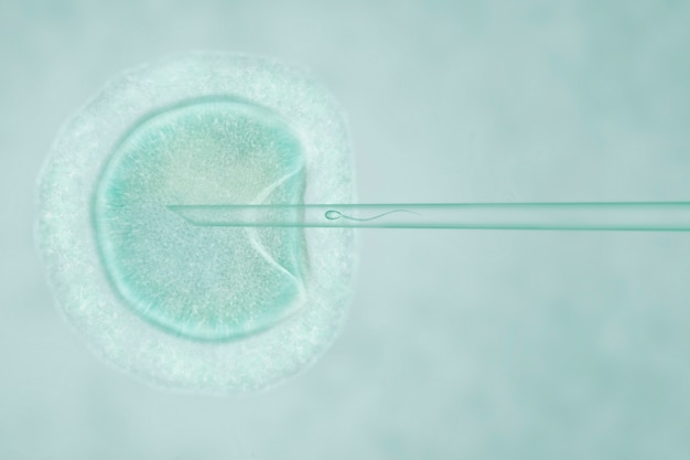 Artificial insemination by intracytoplasmic sperm injection Premium Photo