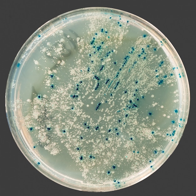 Premium Photo | Bacterial colonies on agar plate