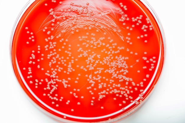 Premium Photo | Bacterial colonies culture on blood agar in microbiology