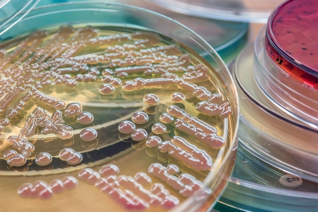 Bacterial Colonies Culture Premium Photo 