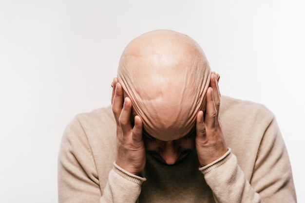 Premium Photo Bald Man Holding His Head In Psychological Stress