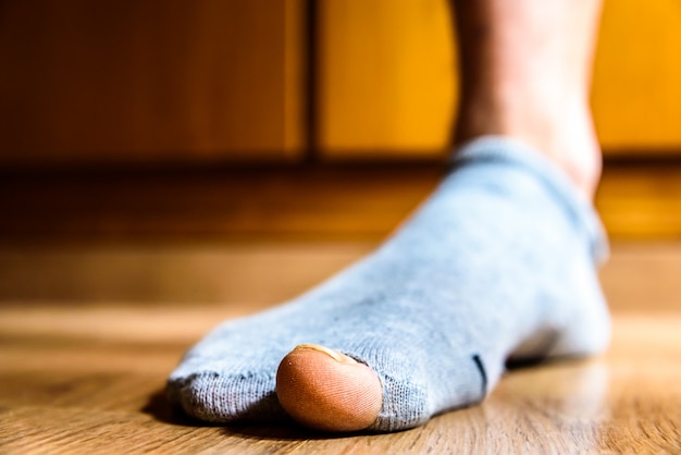 Premium Photo | Broken sock with a hole in a man's big toe, concept of ...