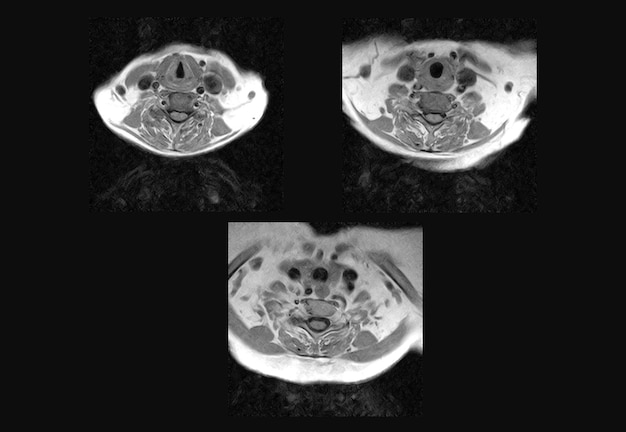 Premium Photo Cervical Spine Mri And Ct Scan Xray Images Professional