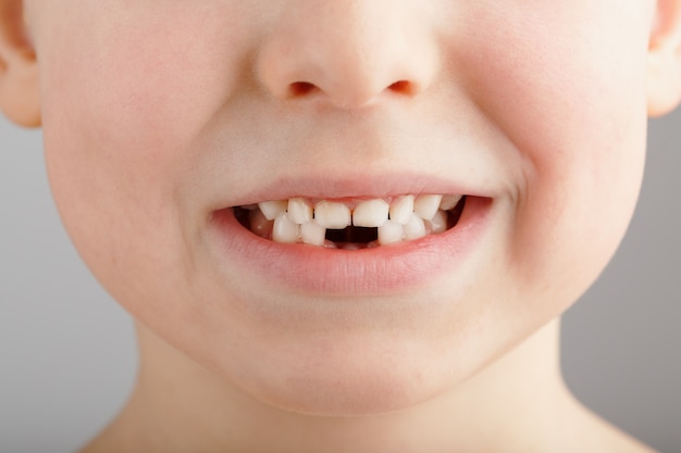 Premium Photo | A child's smile without lower baby teeth. a hole in a ...