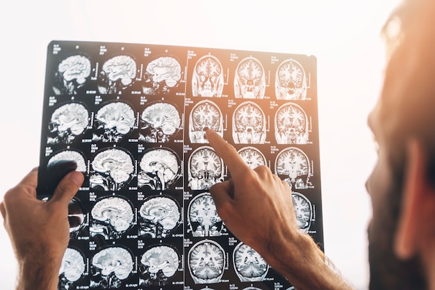 Close-up of a male doctor examine mri x-ray Free Photo