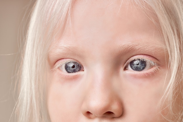 珍しい目 眉毛 まつ毛の色でアルビノの子供のクローズアップ プレミアム写真
