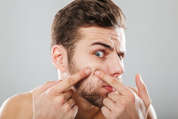 Close up portrait of a man squeezing pimples Free Photo