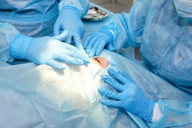 Close up of surgery team operating. the operation on the eye. cataract surgery. laser vision correction. patient and team of surgeons in the operating room, patient under sterile cover Premium Photo