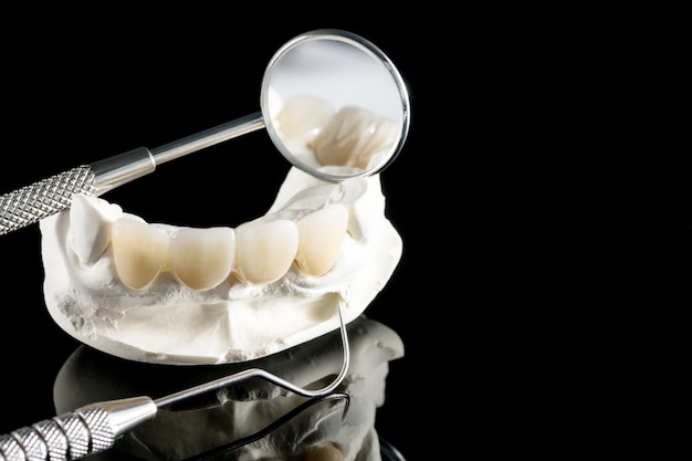 Premium Photo | Closeup / prosthodontics or prosthetic / tooth crown ...