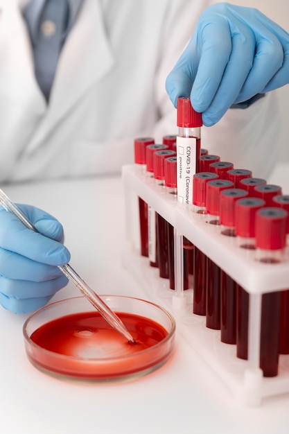 Free Photo | Coronavirus blood samples arrangement in lab