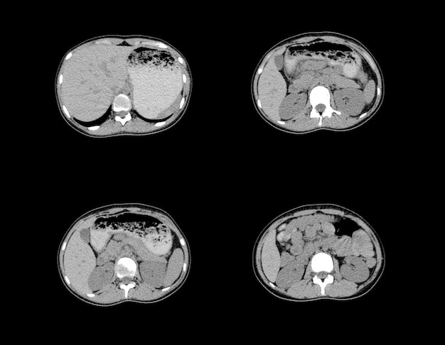 Premium Photo Ct Scan And Mri Abdomen Professional Images