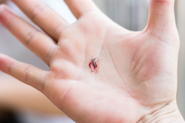 Premium Photo | Dead mosquito on human’s hand after killed