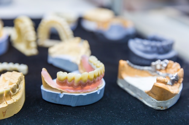 Premium Photo | Denture treatment, dental implants closeup