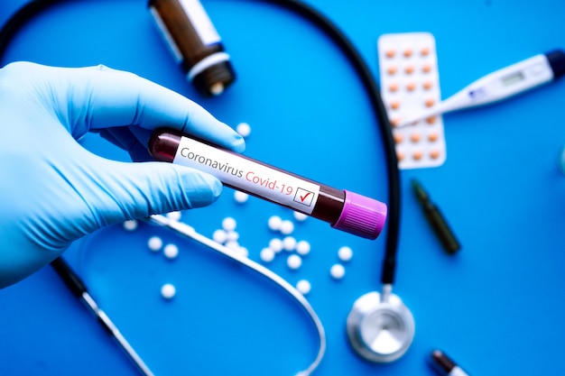 Doctor Hand In Medical Glove Holding Tube With Positive Blood Test