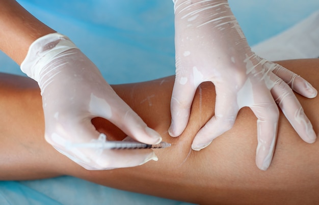 Doctor in medical gloves introduces sclerotherapy on woman's legs, close up Premium Photo