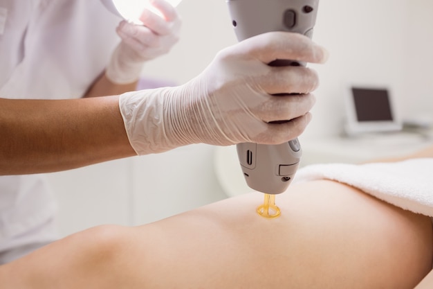 Doctor performing laser hair removal on female patient ...