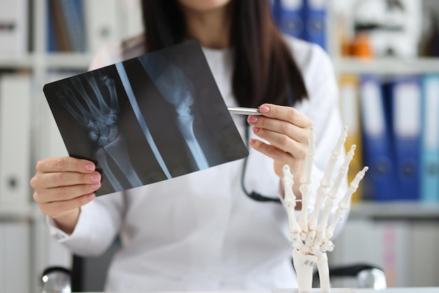 Premium Photo | Doctor traumatologist examines xray with arm injury closeup