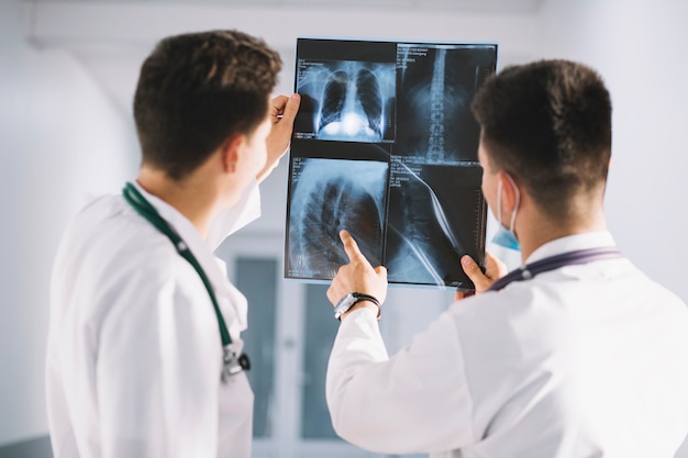 Рентгенография одно из основных направлений в диагностике рака легких