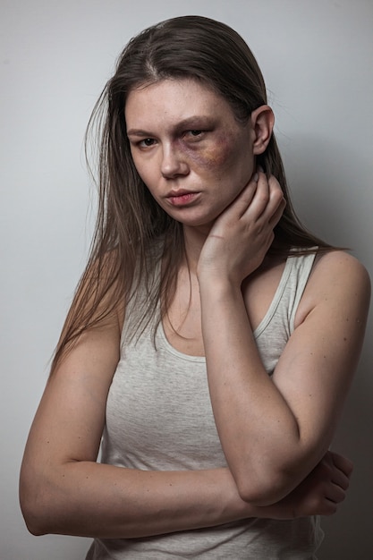 Premium Photo | Domestic Violence, Abuse Woman With Bruise On The Face