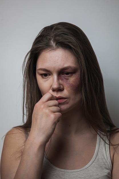 Premium Photo | Domestic Violence, Abuse Woman With Bruise On The Face