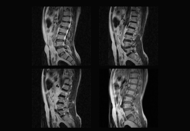 Premium Photo | Dorsal spine mri and ct scan professional xray images