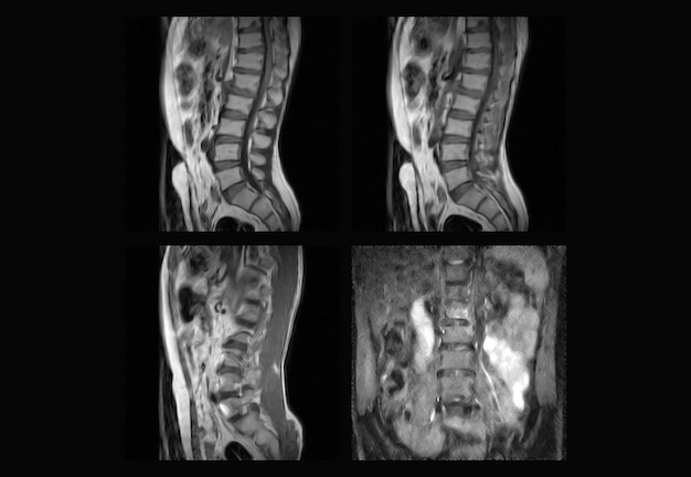 Premium Photo | Dorsal spine mri and ct scan professional xray images