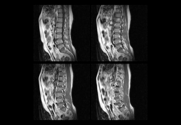 Premium Photo | Dorsal spine mri and ct scan professional xray images