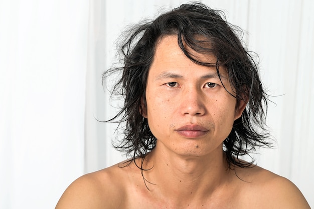 顔のクローズアップ 35 40歳のアジア人男性で 肌に問題があり にきびの跡 しわ 黒ずみ スキンケアの欠如 乾燥肌に水分がない プレミアム写真