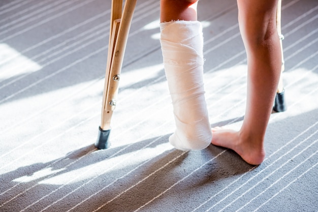 足の骨折 石膏包帯を持つ少女 骨折による怪我の治療のための足副木 トランポリンでジャンプした後の足首の捻挫 プレミアム写真